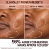 SÉRUM CORRECTOR DE MANCHAS OSCURAS Y RECUPERADOR DE LUMINOSIDAD 10 ML